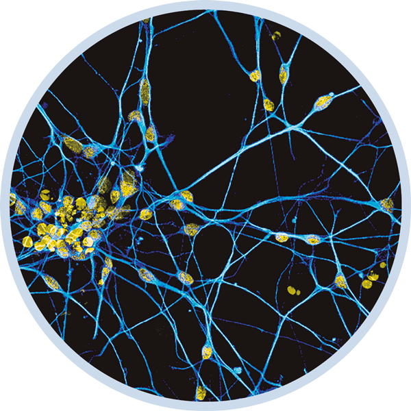 Neurons glowing in the dark. FOTO: Irene Fernádez Carasa © IDIBELL